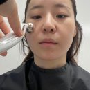 튠페이스 주기,핸드피스비교/턱선 피부 리프팅 효과/튠페이스볼패임 부작용 후기