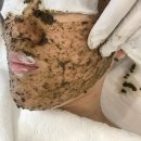 분당 피부관리 라임피부관리실 재방문하여 재생필링 바이오필링 한 후기