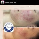 청아세탁소 | 목포 피부 관리샵 여드름 관리 트러블 관리 홈 케어 목포 왁싱 데이 스킨케어(내 돈 내산)