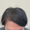 6026 | 헤어스타일에 자신감을 찾게 해주는 부천두피페인팅 전문 혜지오