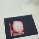 21~24주: 임신중기, 요실금, 얼굴트러블 여전, 육휴시작, 24주 주수촬영, 입체초음파, 임당검사(+재검후기)