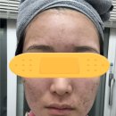 신정약초 이미지