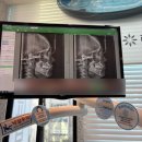 라온미소치과의원 | 전주 교정치과 추천｜10년째 다니는 미소아름치과 정기검진 후기