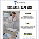 탑조인트의원 이미지