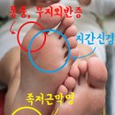 통풍초기 통풍에 좋은음식 안좋은음식 통풍 원인 이미지