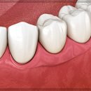 메리트치과의원 이미지