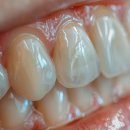 열린오치과의원 이미지