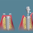 ONE DENTAL 이미지