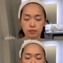 코아메디칼 | 서면윤곽관리 추천 코아페이즈 윤곽리프팅관리 후기 부산신부관리 전문 케어