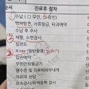 빅3 아산병원 소아비뇨 후기 수신증 or 물혹