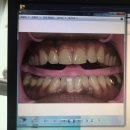 강서탑치과의원 이미지