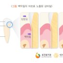 이에.