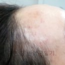 권헤어라인 이미지