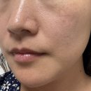 (주)영양아폴론태양광 | 주름개선 수분에센스 루미푸라 촉촉한 후기