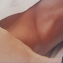 반듯한 멍이 이미지