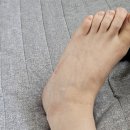 가로수동물병원 | [일상] 오른쪽 발목 인대 파열되다