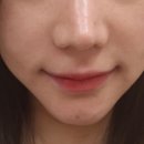 소피뷰티 | 대전 서구 피부관리 4회차 내돈내산 후기 소피뷰티
