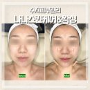 수지피부관리 나나스킨케어&amp;왁싱 케라손케어 탄력 수분 멀티관리