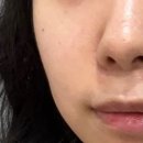 주엘스킨테라피 | [뷰티] 청담동 에스테틱 주엘 스킨테라피에서 피부관리