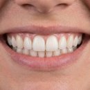 퍼스트사랑니치과의원 이미지