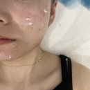전주슈퍼젝션 받으러 다녀온 혁신도시피부관리 아누보스킨