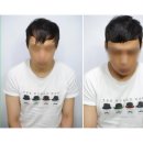 여자앞머리탈모,헤어 증모술로 이제 헤어라인 탈모 걱정은 baybay~[ps. 결혼식머리 ~ 면접 전~ 증명사진...