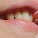 바이제로(Vi-Zero) 이미지