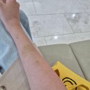 한마음실비 | 담낭절제술 후 외래 결과·병원비·달라진 삶 | 창원한마음병원 로봇수술 후기 4편 (마지막)