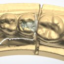 바라던 치과기공소 이미지