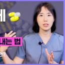 [여성호르몬치료 Ep9] 여성 호르몬제 부작용, 어떤 부작용 어떻게 예방할까? [대구갱년기클리닉, 대구여의사산부인과] 이미지