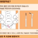 큰사랑치과 네이버블로그