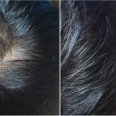 림 스칼프 네이버블로그