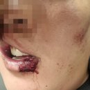 데이트폭행 목격 신고자, 무소불위 경찰에 항의했다가 폭행당해 피해자 바뀌었다 그래서 나는 이제 선택적으로 신고할 것이다 이미지