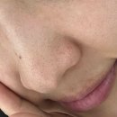 연화제 | 피지연화제 좁쌀 케어 내돈내산 후기