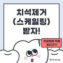 겨레치과의원 | 치석 제거(스케일링) 건강보험 적용 되나요?