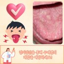 베체트병 병의원 찾는다면 류마티스내과 진료가 필요한 이유