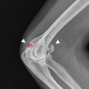 새본 정형외과 이미지