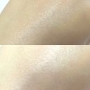 케이씨알 메디칼 | 파우더걸) 비오니케 디펜스 바디 안티셀롤라이트 세럼으로 바디를 매끈하게 관리해보았어요