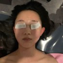 알엑스퍼트홍대 | [신촌 피부관리] 알엑스퍼트 신촌점에서 홍조앰플 관리 받아본 솔직후기
