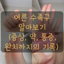 금주어린이집 | 어른 수족구 초기증상 목통증 전염 수포 입안 병원 약 완치 후기