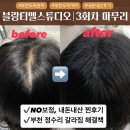 티엘 | 【블랑티엘 스튜디오】 두피 커버 SMP 내돈내산 후기
