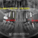 서림동-13 이미지