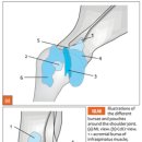 Prevalence of mineralisation of the tendon of the supraspinatus m. 이미지