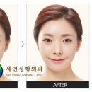 세인성형외과 이미지