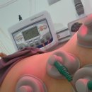 원주단구 오케이한의원 | 갱년기 관절통 치료 중 원주시 단구오케이한의원