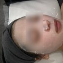 성남 위례 피부관리 RET고주파 솔직후기 [순수뷰티] 탄력있는 피부 만들기