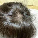 루토닉스 로즈마리 스칼프 두피 헤어 토닉 사용 후기