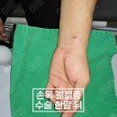 삼성서울정형외과 이미지
