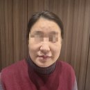 전의를디자인하는사람들 | [내돈내산] 홍대입구역피부과 실리프팅(원더트리플) 후기! 40대 워킹맘의 탄력 리셋 기록