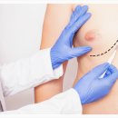 여유증 수술 가격? 전문의가 총정리해 드립니다